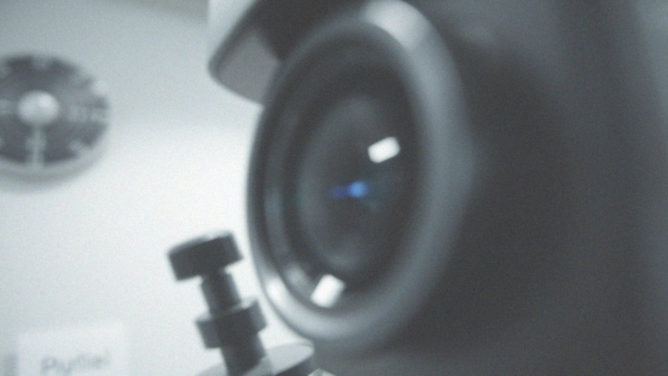 Jakie objawy towarzyszą autoimmunologicznemu zapaleniu rogówki?