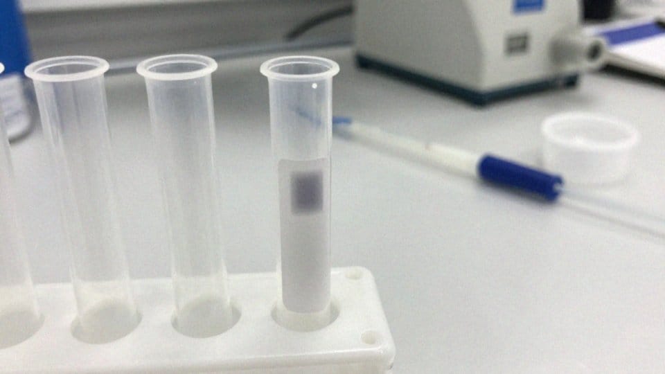 Jakie są ograniczenia testów w mononukleozie?