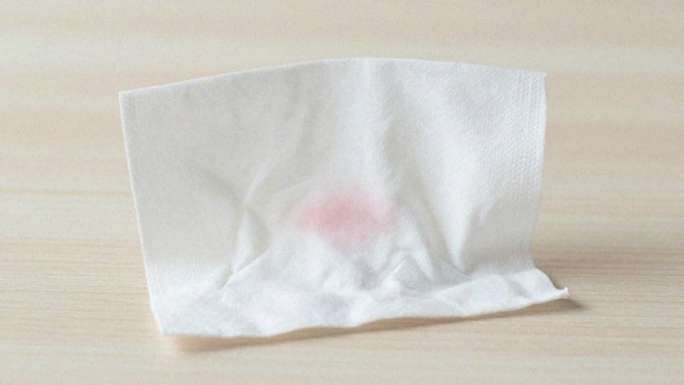 Jakie są objawy zapalenia spojówek?